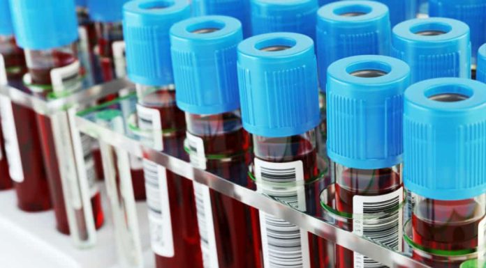 Иглы-бабочки: эффективный способ взятия крови