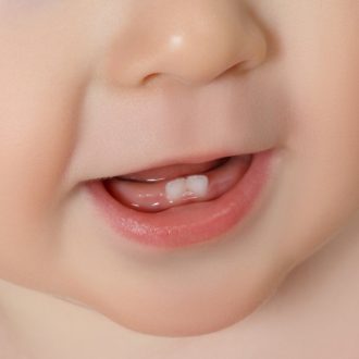 Суспензия Нурофен при прорезывании зубов у детей