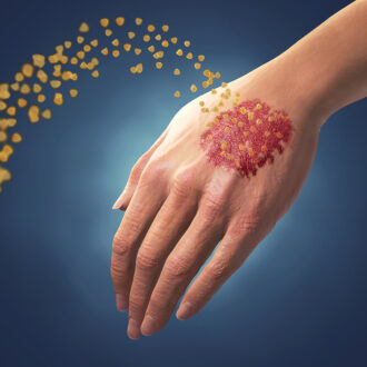 Хроническое заболевание, которое можно контролировать в домашних условиях