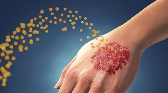 Хроническое заболевание, которое можно контролировать в домашних условиях