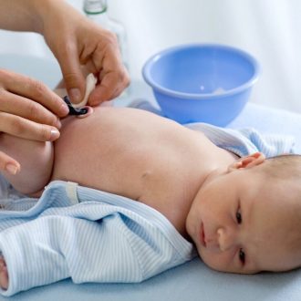 Пуповина у новорожденного: как обрабатывать, когда отваливается