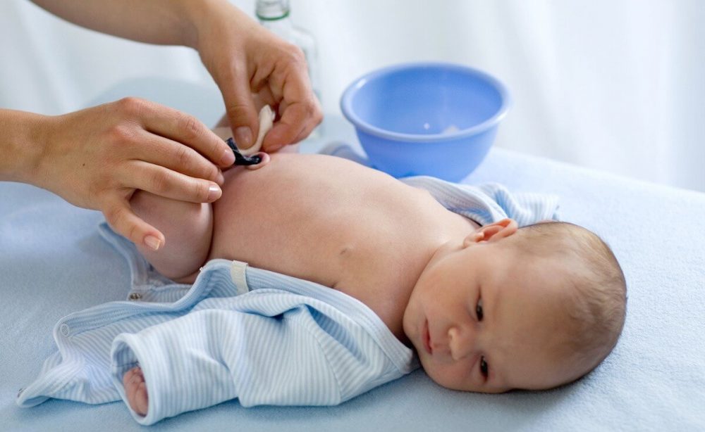 Пуповина у новорожденного: как обрабатывать, когда отваливается