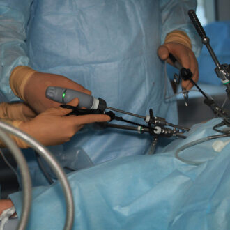 Удаление желчного пузыря лапароскопическим методом