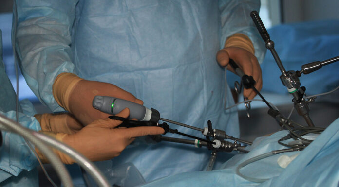 Удаление желчного пузыря лапароскопическим методом