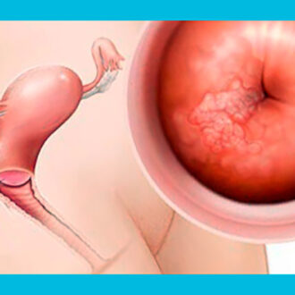 Шеечный фактор бесплодия: симптомы, лечение и зачатие