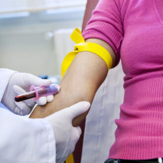 Тест на антитела к коронавирусу – как подготовиться?