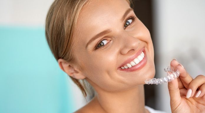 Чем популярны элайнеры Инвизилайн?