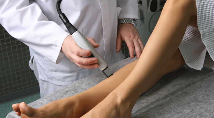 Лечение варикоза лазером