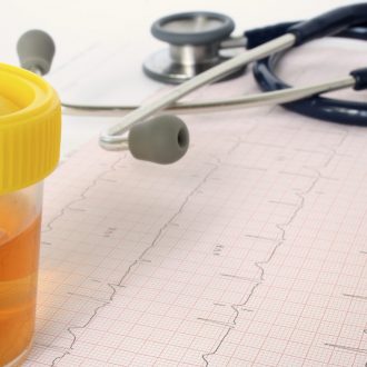 Опасно ли наличие кетоновых тел в моче при беременности?