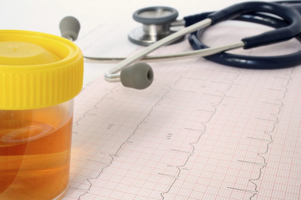 Опасно ли наличие кетоновых тел в моче при беременности?