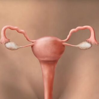 Трубный фактор бесплодия — причины, симптомы, профилактика