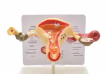 Пролапс матки: от первых симптомов до современных методов лечения