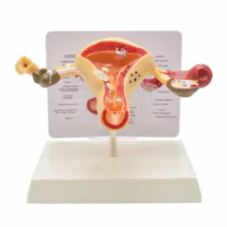 Пролапс матки: от первых симптомов до современных методов лечения