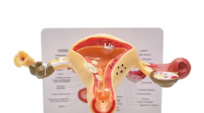 Пролапс матки: от первых симптомов до современных методов лечения