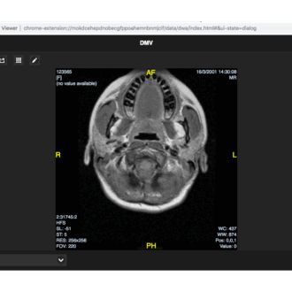 Универсальный онлайн DICOM-вьюер: современные решения для медицинской визуализации