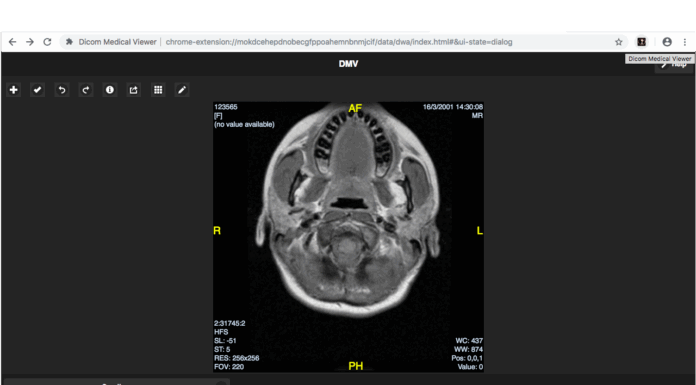 Универсальный онлайн DICOM-вьюер: современные решения для медицинской визуализации