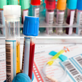 Анализы в Москве