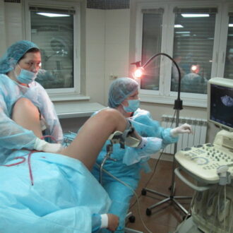 Бесплодие после аборта: как избежать осложнений