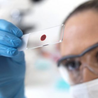 Как меняется значение ХГЧ при внематочной беременности?